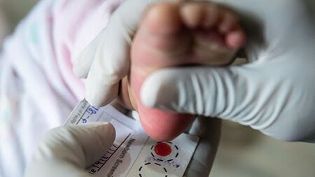 نوزادان تازه متولد شده، تحت غربالگری بیماری های متابولیک ارثی قرار می‌گیرند
